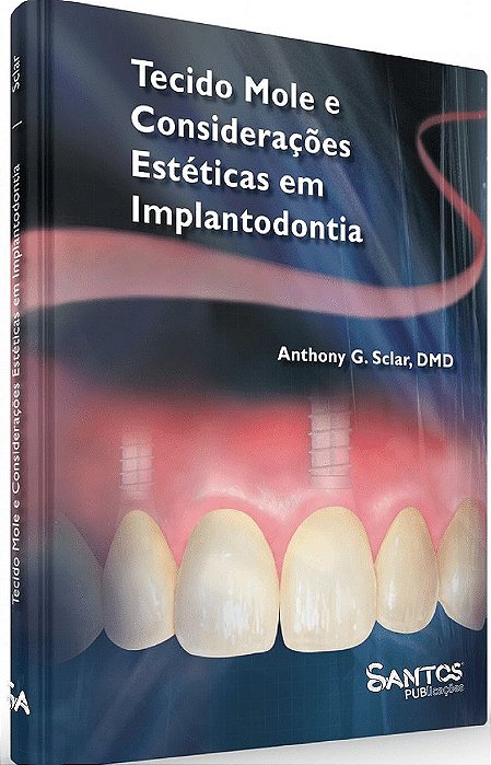Livro Tecido Mole e Consideracoes Esteticas em Implantoterapia - Sclar