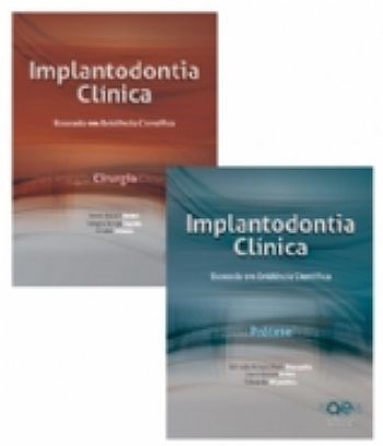 Livro Implantodontia Vol. 1 - Clinica Baseada em Evidencia Cientifica - Cirurgia - Shibli/jayme/zetola