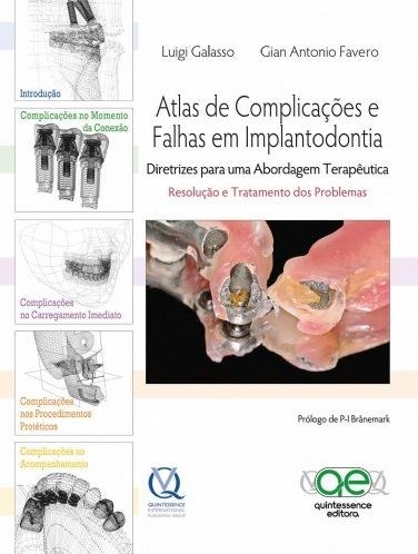 Livro Atlas de Complicações e Falhas em Implantodontia