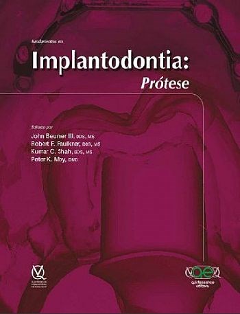 Livro Fundamentos em Implantodontia: Protese - Beumer Iii