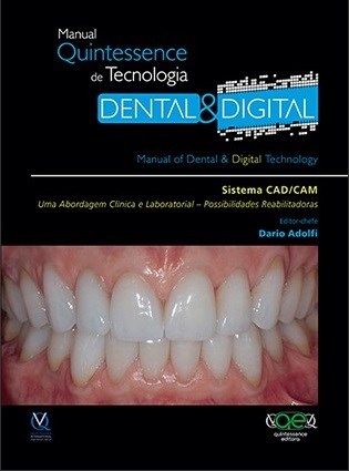 Livro Sistema Cad-cam. Uma Abordagem Clinica e Laboratorial. Possibilidades Reabi - Adolfi