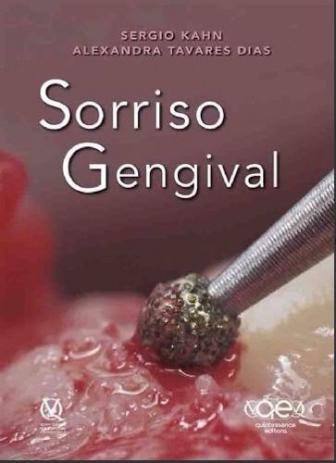 Livro Sorriso Gengival - Kahn - Santos Pub