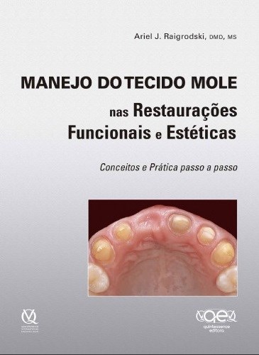 Livro Manejo do Tecido Mole Nas Restauracoes Funcionais e Esteticas Conceitos E - Raigrodski