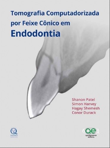 Livro Tomografia Computadorizada por Feixe Conico em Endodontia - Patel/harvey/shemesh