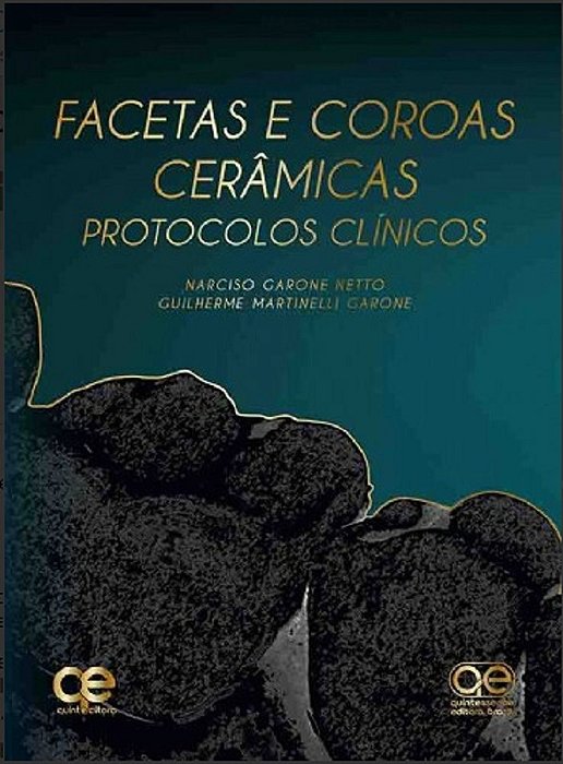 Livro Facetas e Coroas Cerâmicas:  Protocolos Clínicos