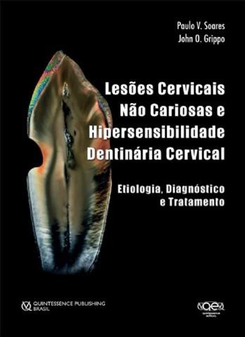 Livro Lesoes Cervicais Nao Cariosas E Hipersensibilidade Dentearia Cervical: Etio - Soares/grippo