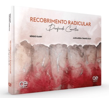 Livro Recobrimento Radicular Desafiando Conceitos