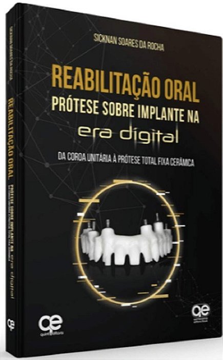 Livro Reabilitação Oral: Prótese sobre Implante Na era Digital - Rocha - Napoleão