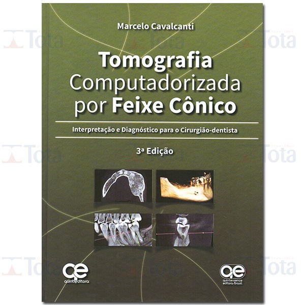 Livro Tomografia Computadorizada por Feixe Cônico