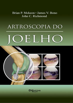 Livro Artroscopia do Joelho