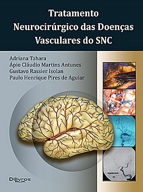 Livro Tratamento Neurocirúrgico das Doenças Vasculares do SNC