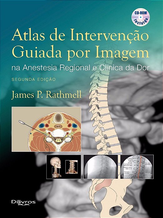 Livro Atlas de Intervenção Guiada por Imagem na Anestesia Regional e Clínica