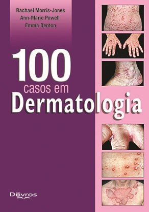 Livro 100 Casos em  Dermatologia