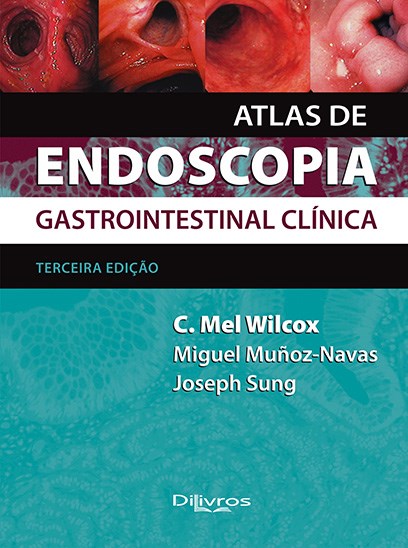Livro Atlas de Endoscopia Gastrointenstinal Clínica