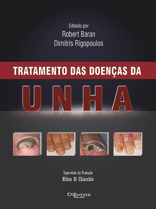 Livro Tratamento das Doenças da Unha Baran