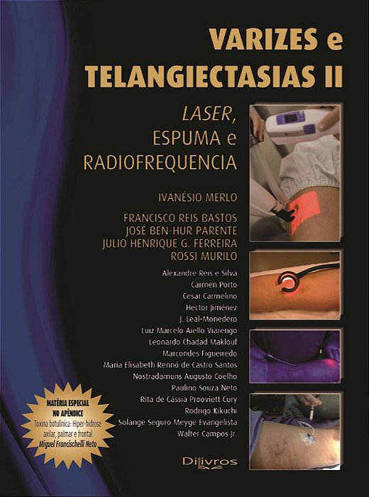Varizes e Telangiectasias Ii: Laser, Espuma e Radiofrequência