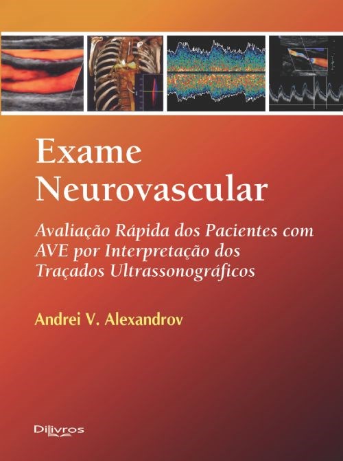 Livro Exame Neurovascular Avaliação Rápida dos Pacientes com Avc