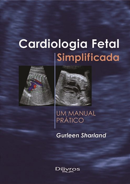 Cardiologia Fetal Simplificada - Sharland - Dilivros