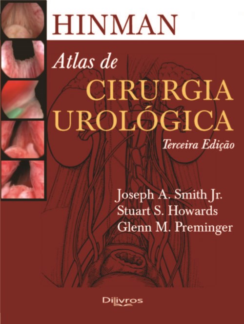 Livro Atlas de Cirurgia Urológica Smith Jr