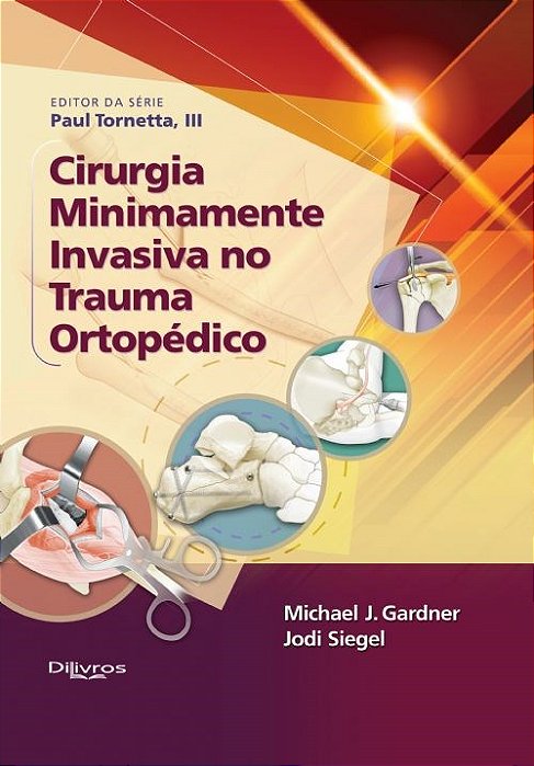 Livro Cirurgia Minimamente Invasiva no Trauma Ortopédico  Gardner