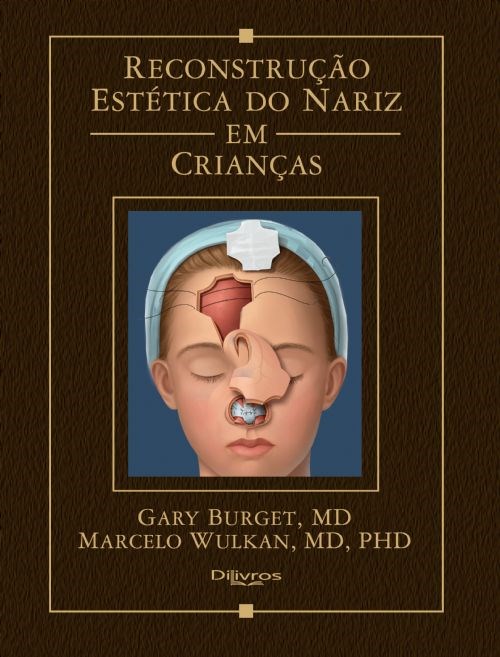 Livro Reconstrução Estética do Nariz em Criancas   Burget