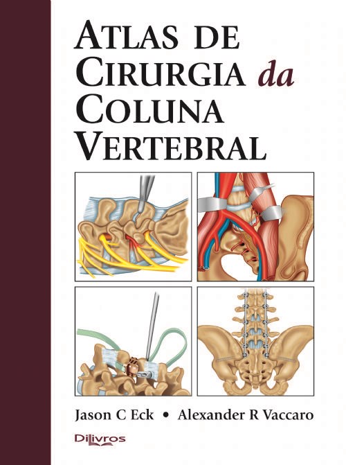 Livro Atlas de Cirurgia da Coluna Vertebral  Vaccaro