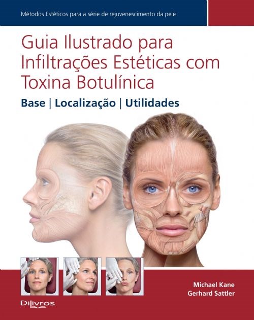 Livro Guia Ilustrado para Infiltrações Estéticas com Toxina Botulínica