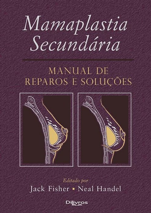Livro Mamaplastia Secundária Manual de Reparos e Soluções