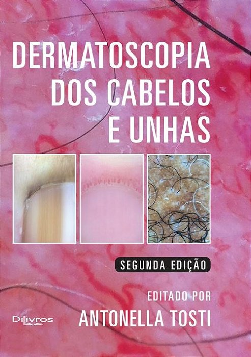 Livro Dermatoscopia dos Cabelos e Unhas