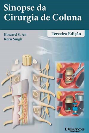 Livro Sinopse da Cirurgia de Coluna