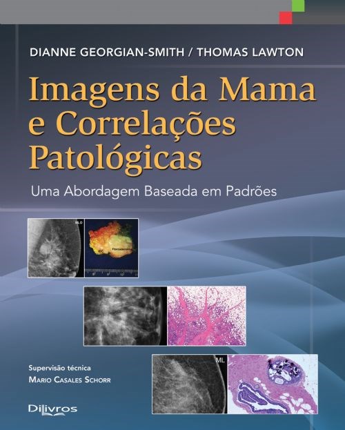 Livro Imagens da Mama e Correlações Patológicas