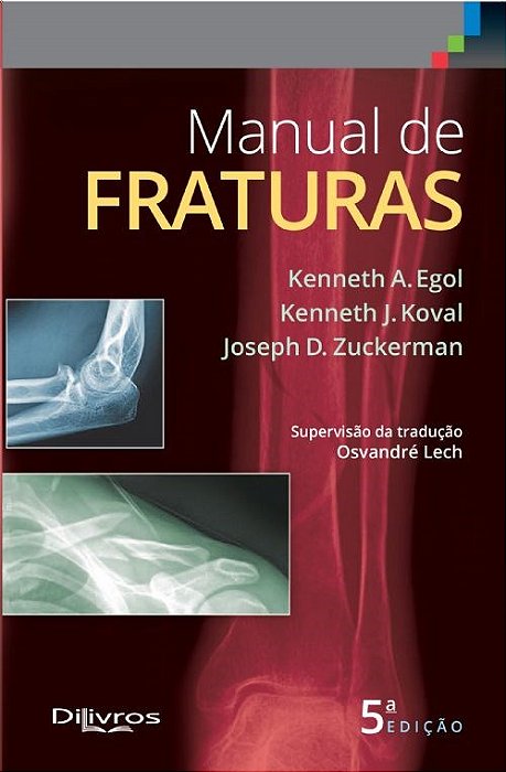 Livro Koval Manual de Fraturas