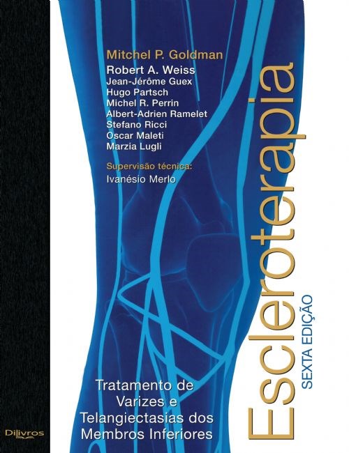Livro Escleroterapia Goldman