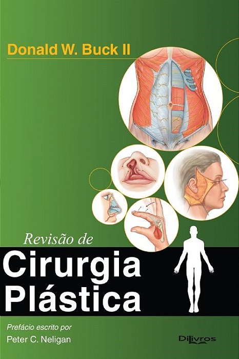 Livro Revisão de Cirurgia Plástica  Buck Il