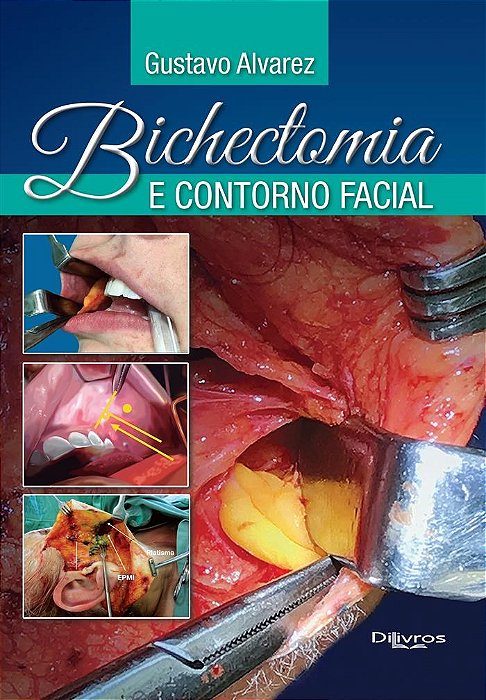 Livro Bichectomia e Contorno Facial  Alvarez