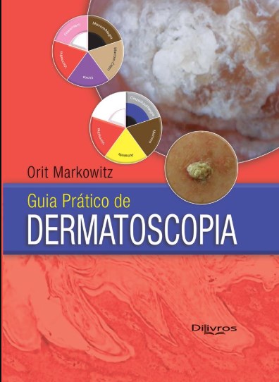 Guia Prático de Dermatoscopia - Markowi - Dilivros