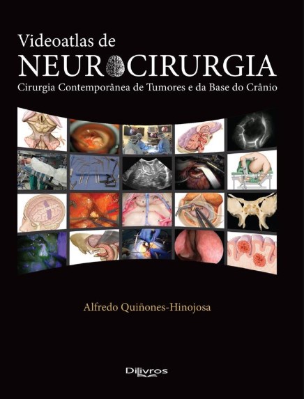Livro Videoatlas de Neurocirurgia