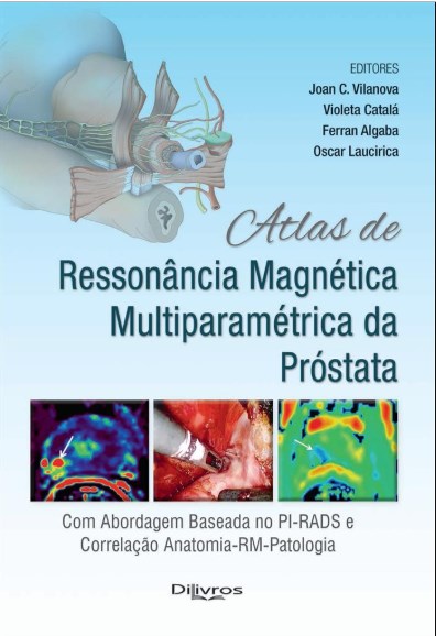 Livro Atlas de Ressonância Magnética Multiparamétrica da Próstata - Vilanova - Dilivros