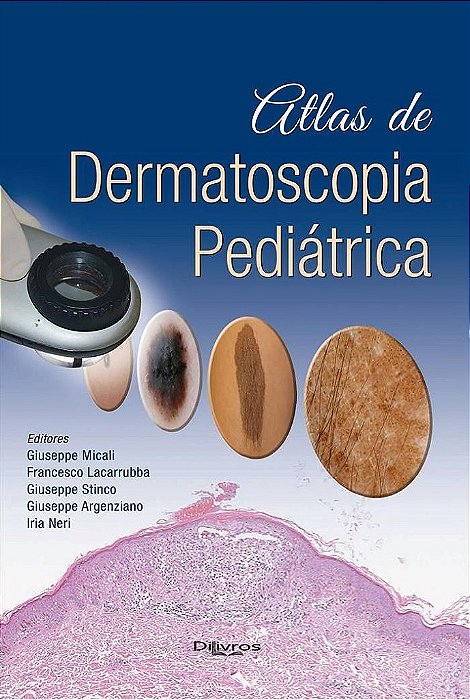 Livro Atlas de Dermatoscopia Pediátrica