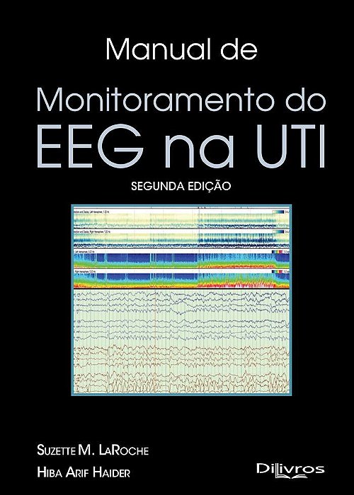 Livro Manual de Monitoramento do EEG na UTI