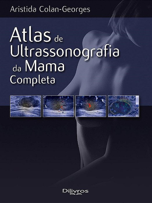 Livro Atlas de Ultrassonografia da Mama Completa  Colan