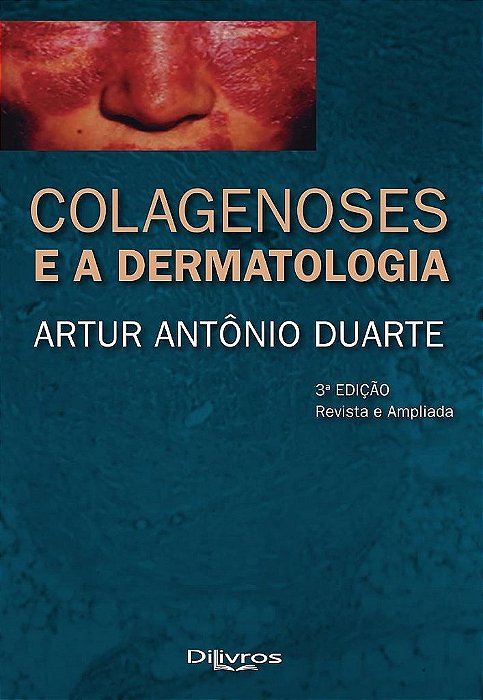 Livro Colagenoses e a Dermatologia Duarte