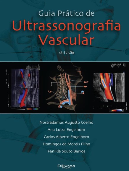 Guia Prático de Ultrassonografia Vascular - Engelhorn - Dilivros