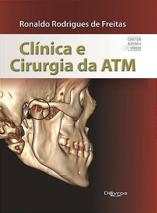 Livro Clínica e Cirurgia da ATM  Freitas