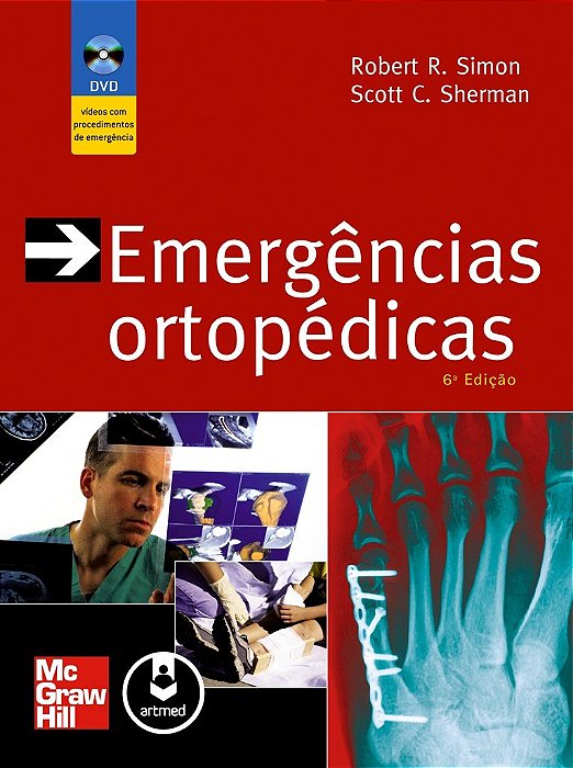 Livro Emergências Ortopédicas - Simon - McGraw