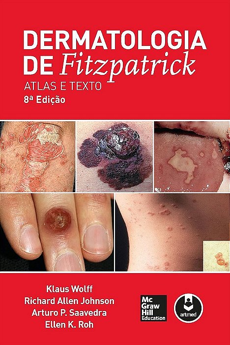 Livro Dermatologia de Fitzpatrick Atlas e Texto - Wolff - McGraw