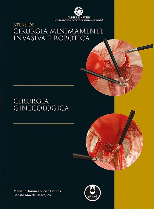 Livro Atlas de Cirurgia Minimamente Invasiva e Robótica: Cirurgia Ginecológica
