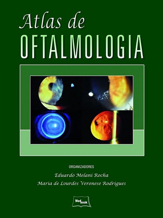 Livro Atlas de Oftalmologia - Rocha