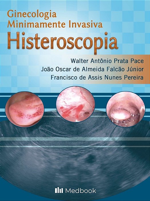 Livro Histeroscopia: Ginecologia Minimamente Invasiva  Pace