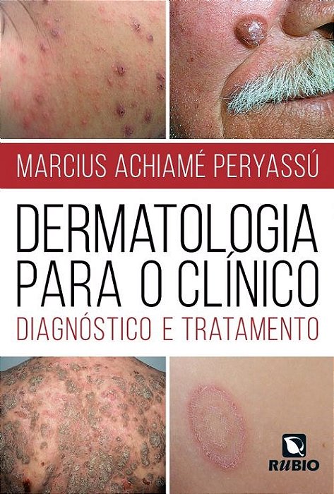Livro Dermatologia para o Clinico: Diagnostico e Tratamento - Peryassu